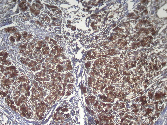 RPS15 Antibody