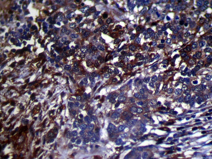 GMFB Antibody