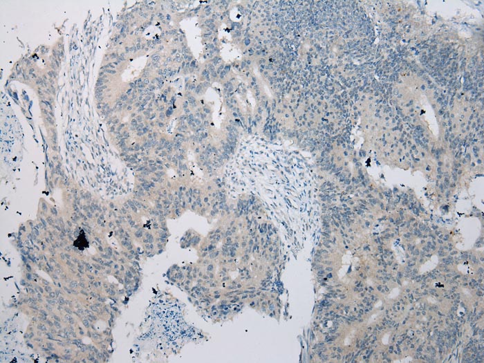 GTF2H2 Antibody
