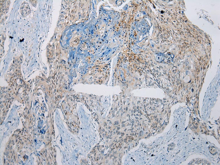 GTF2H2 Antibody