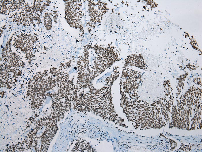 ZNF22 Antibody