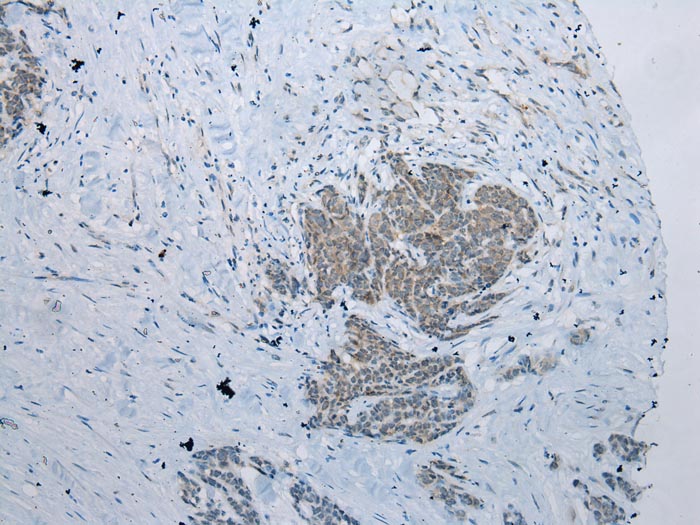 NAA60 Antibody