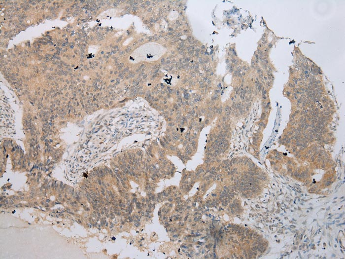 UBE2Z Antibody