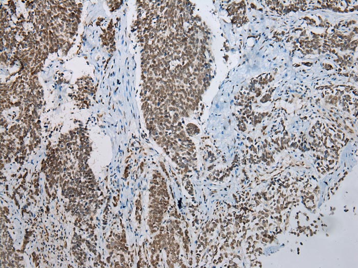 NSMCE2 Antibody