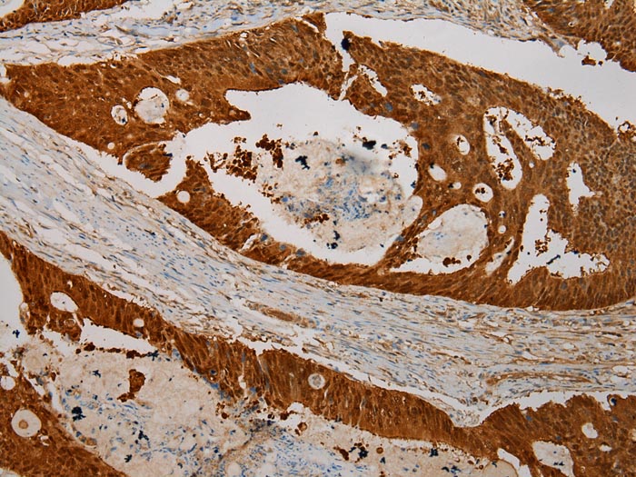 CMPK1 Antibody