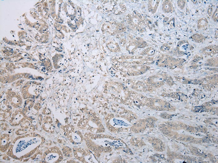 TADA2A Antibody
