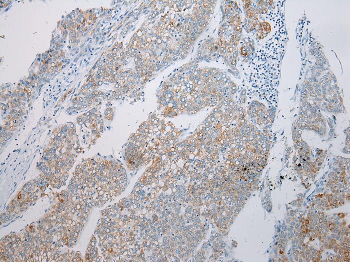 MGST1 Antibody