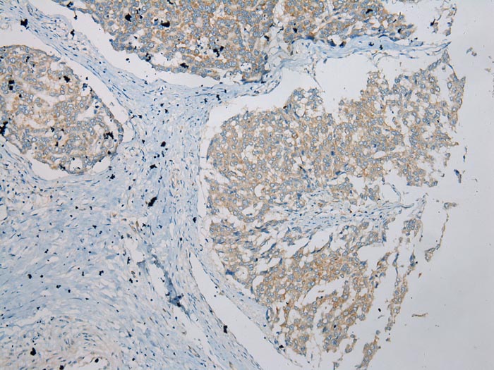 UBTD2 Antibody