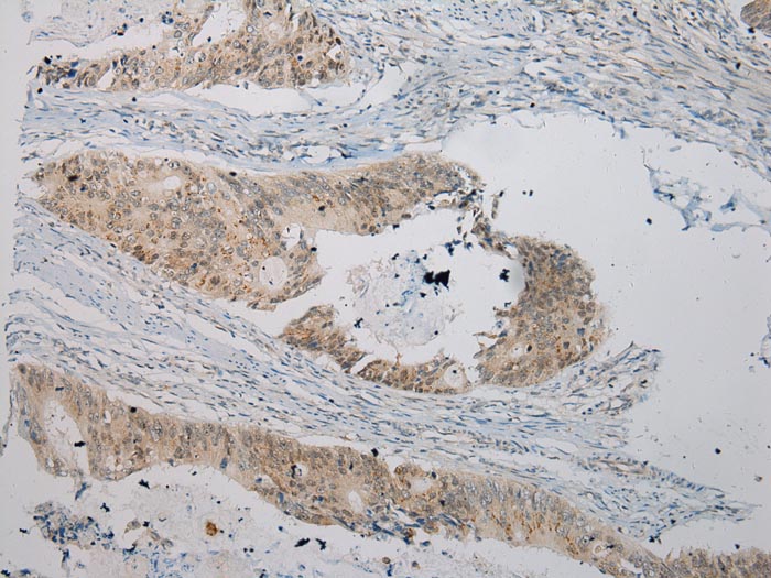 UGT1A6 Antibody