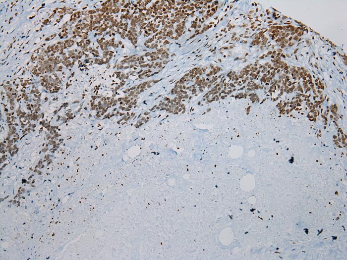 ZNF200 Antibody