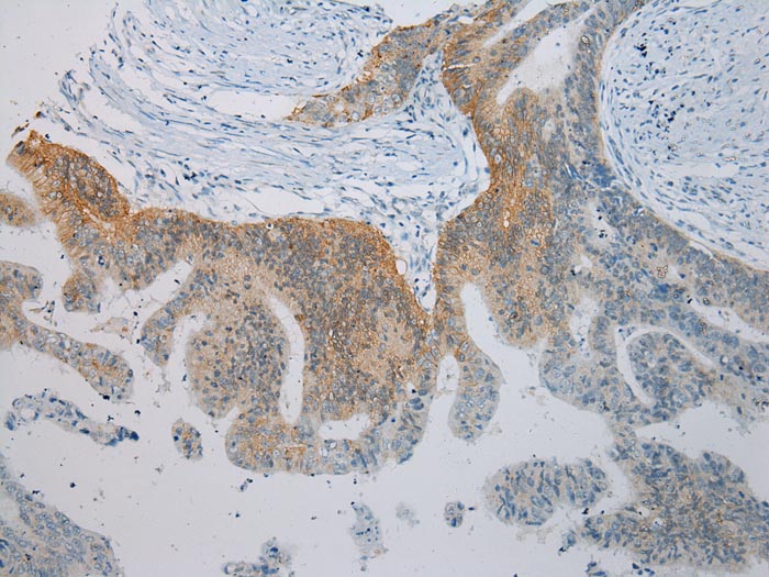 TLK2 Antibody
