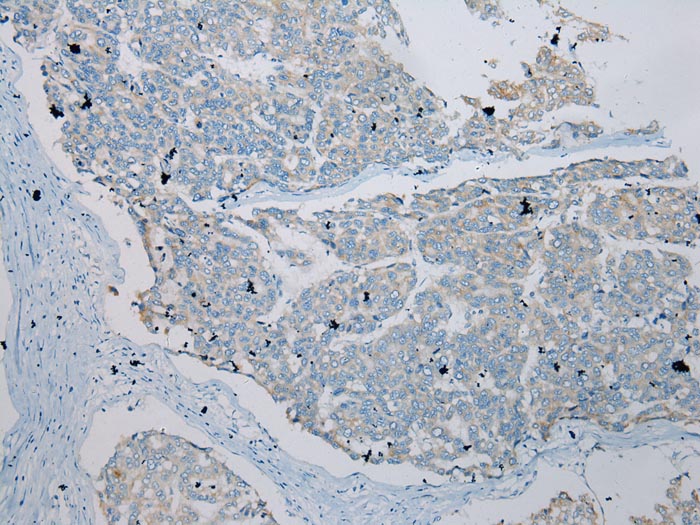 TLK2 Antibody
