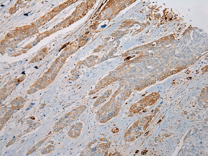 TREM1 Antibody
