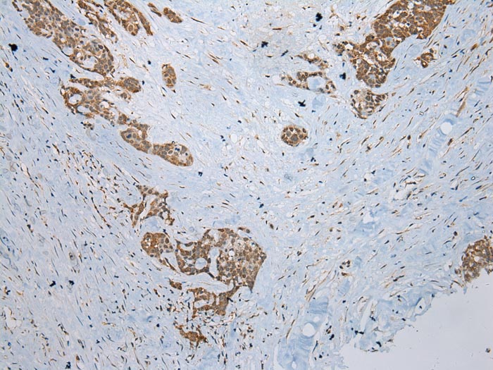 CCBL1 Antibody
