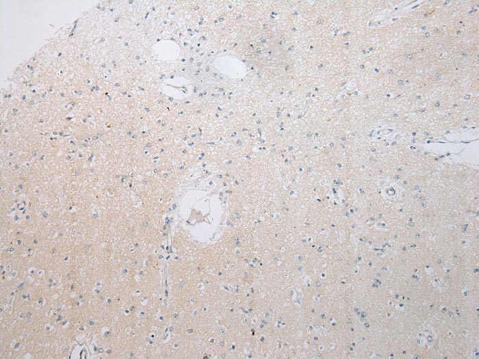 RPS15A Antibody