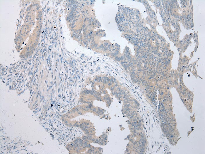 BBS9 Antibody