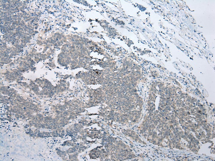 BBS9 Antibody