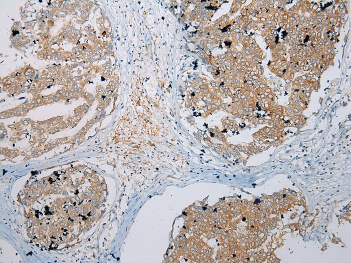 ZNF621 Antibody