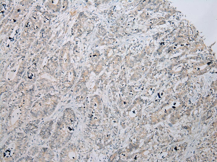 ZNF621 Antibody