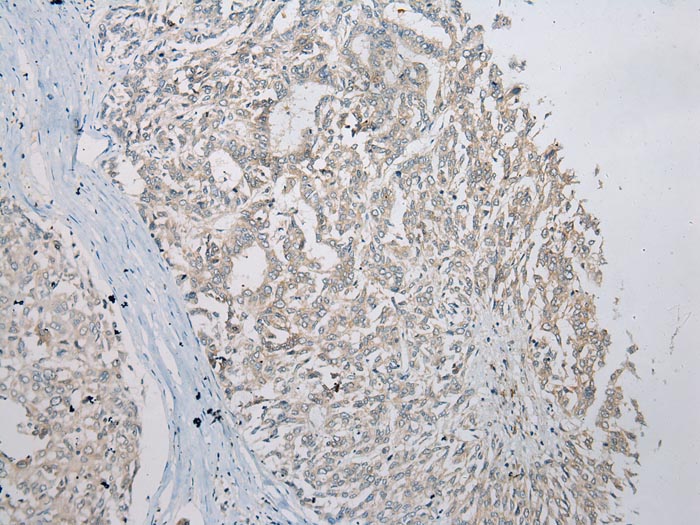 SLC35E2 Antibody
