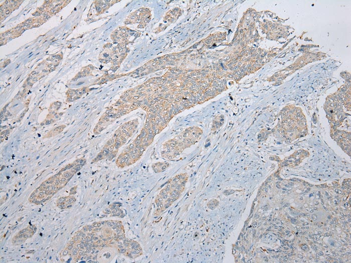 RSPH1 Antibody