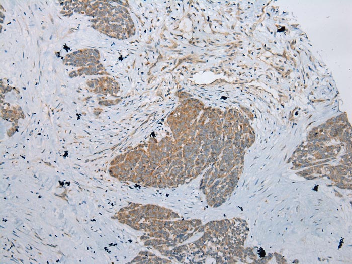 RSPH1 Antibody