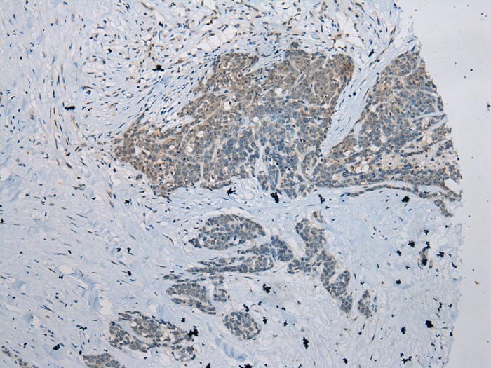 ZNRD1 Antibody