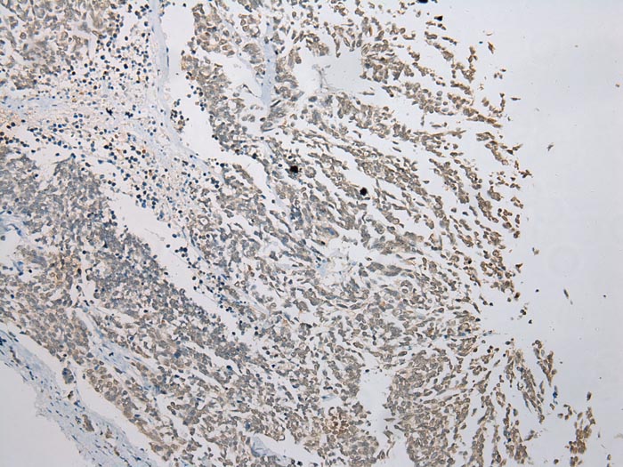 FAM101A Antibody