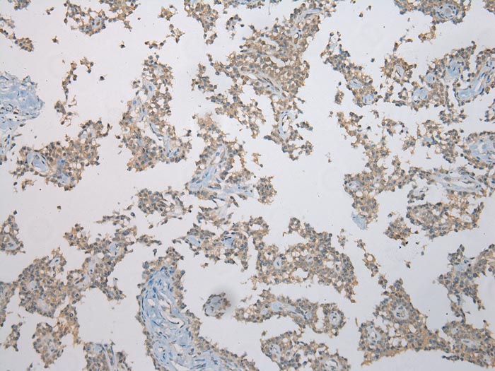 FAM101A Antibody