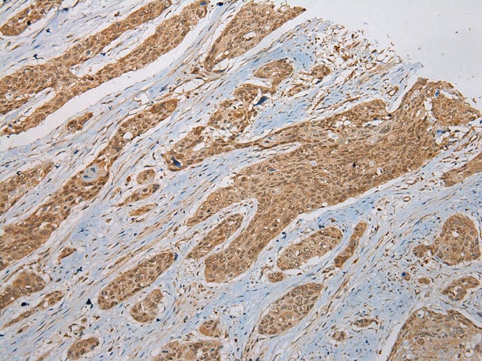 ZNF248 Antibody