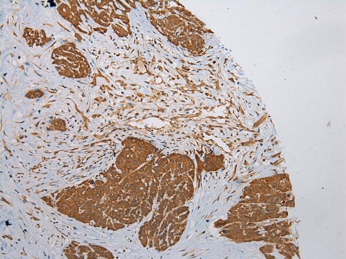 ZNF248 Antibody
