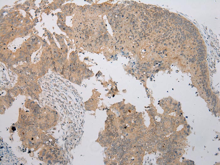NUDT6 Antibody