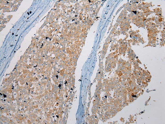 NUDT6 Antibody