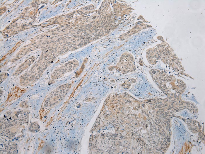 PLA2G12A Antibody