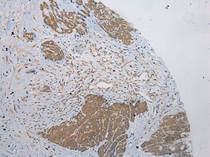 PLA2G12A Antibody