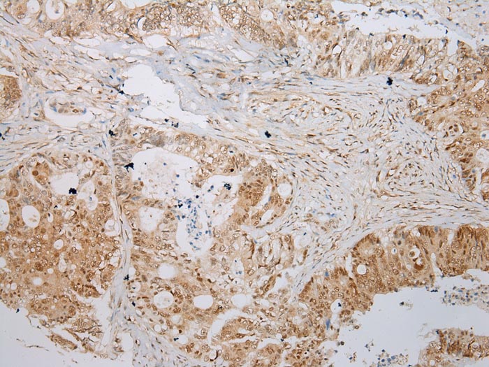 ABHD14B Antibody