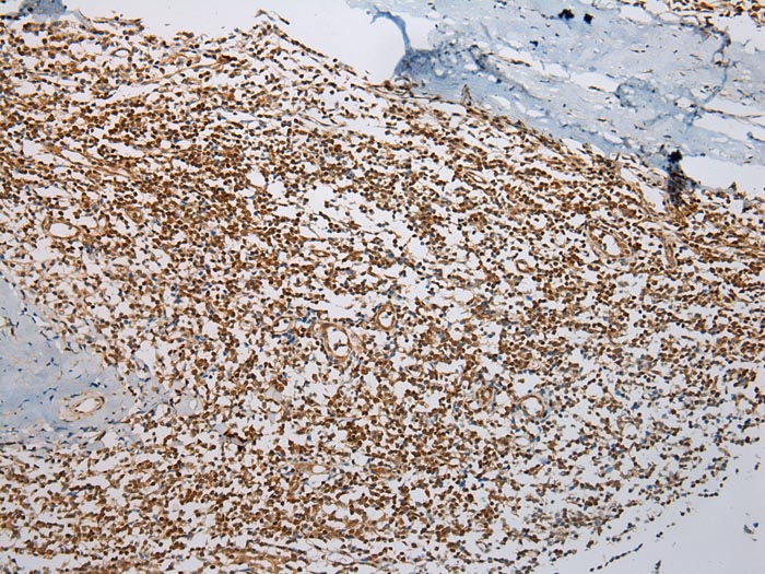 ABHD14B Antibody