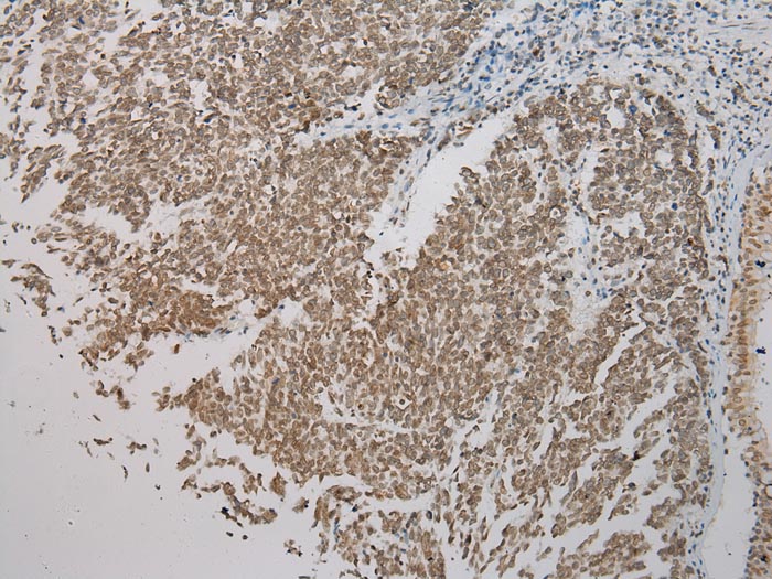 SMYD2 Antibody