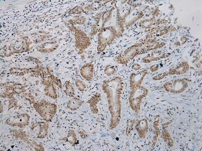 ZNF473 Antibody