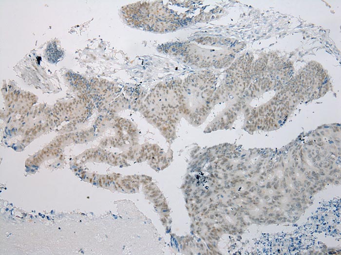 ARFGAP2 Antibody
