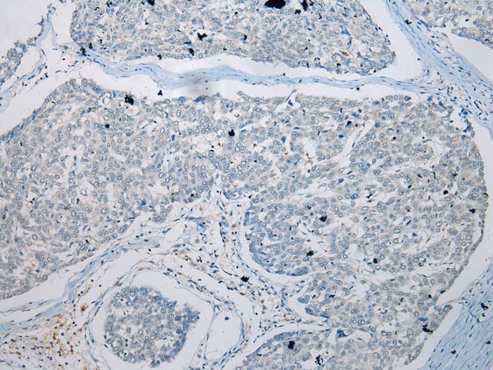 GDF10 Antibody