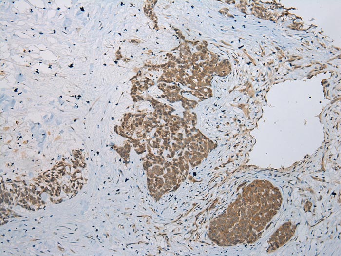 GLI2 Antibody