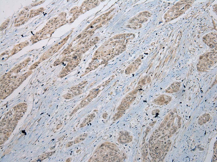 GLI2 Antibody