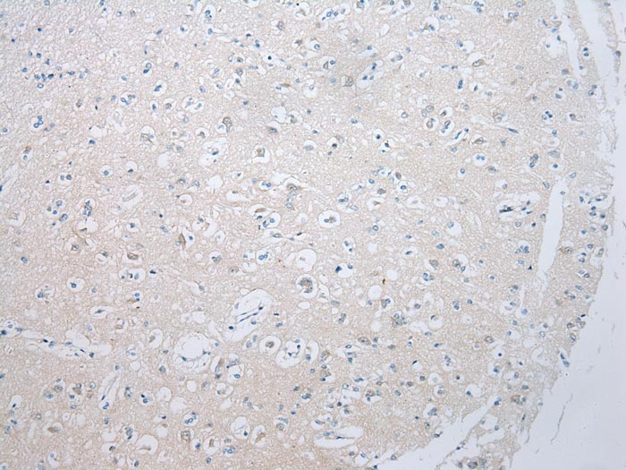 ADAMTS8 Antibody