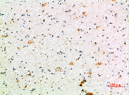 CD64 Polyclonal Antibody