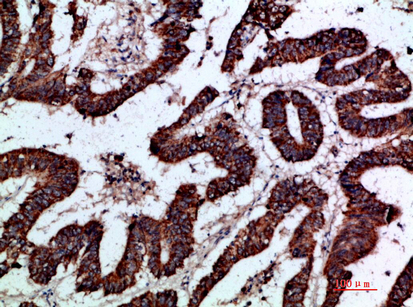 Gremlin-2 Polyclonal Antibody