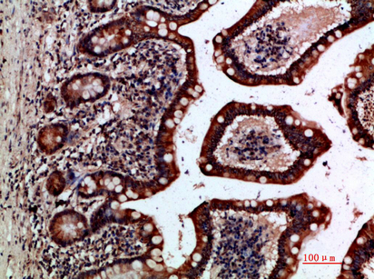 Gremlin-2 Polyclonal Antibody