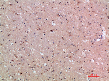 ASCL1 Polyclonal Antibody