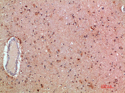 MLL Polyclonal Antibody