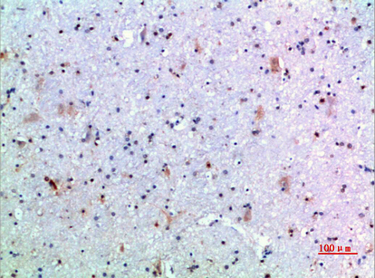 GH Polyclonal Antibody